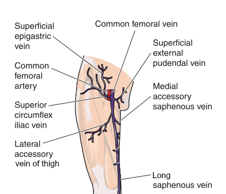 Varicose veins leg groin with anatomic diagram of draining veins