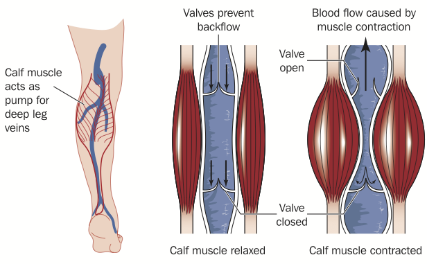 Varicose veins definition explanation beginning with the muscle pump - in this case the calf muscle pump returning blood back to your heart.