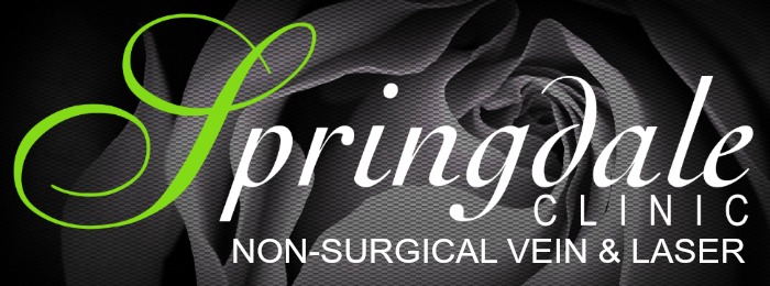 Springdale your local dedicated varicose vein clinic